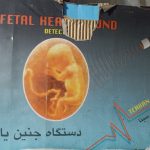فروش دستگاه جنین یاب