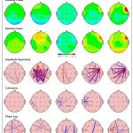 دستگاه QEEG 24 کاناله و نوروفیدبک