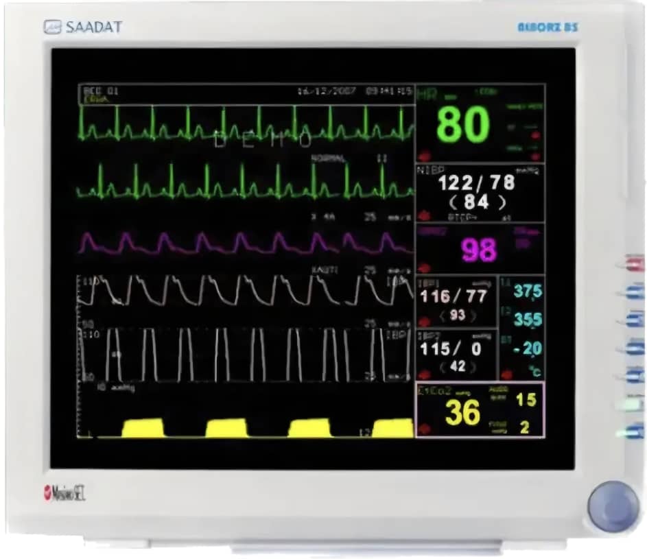 مانیتور علایم حیاتی